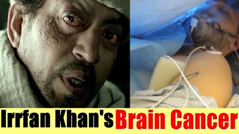 I have had the fourth cycle of chemotherapy:  Irrfan Khan (Neuroendocrine Tumor)
